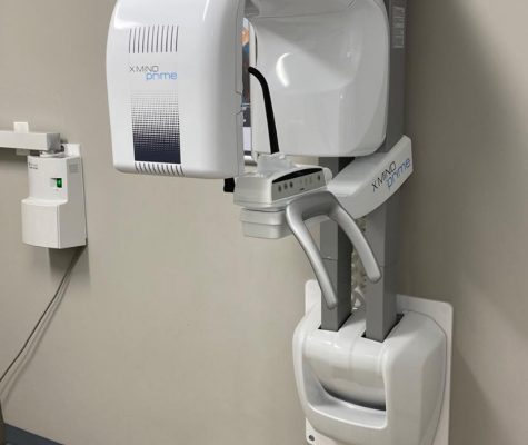 Union Dental 3D Scanner